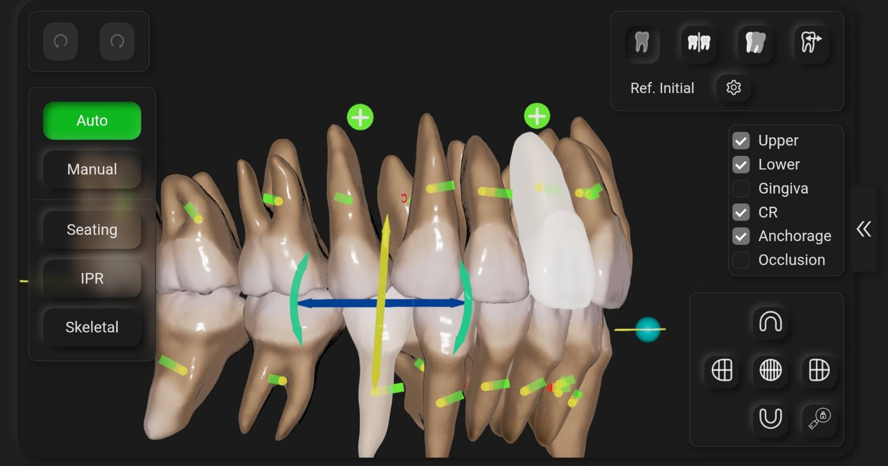 シミュレーション画像②