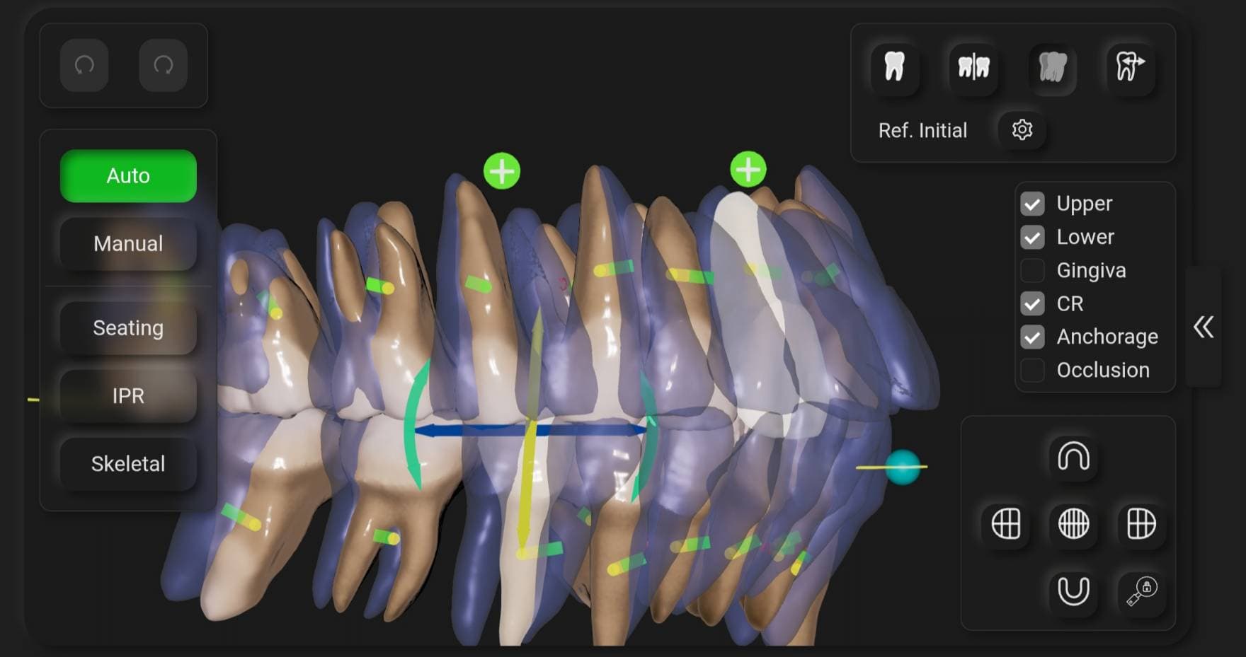 シミュレーション画像①